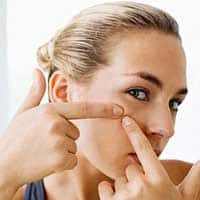 Fabels en feiten over acne