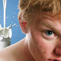 Melk en Acne - Wat is de invloed van melk op puistjes Melk en Acne - Wat is de invloed van melk op puistjes